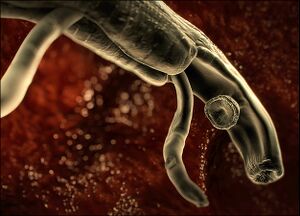 Parasite Type IV.jpg