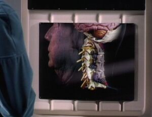 Neural parasite quinn.jpg